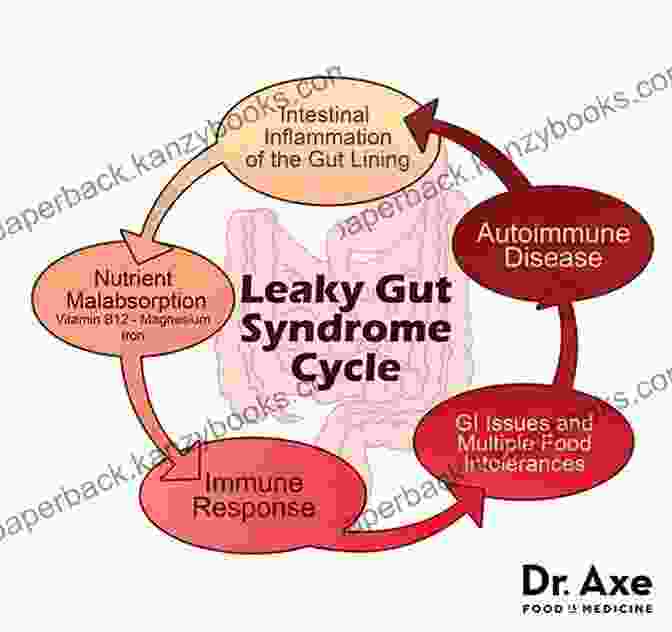 Diagram Illustrating The Concept Of Leaky Gut Eat Dirt: Why Leaky Gut May Be The Root Cause Of Your Health Problems And 5 Surprising Steps To Cure It