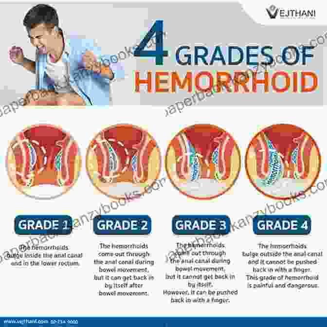 Diet And Hemorrhoids AMAZING NATURAL CURE FOR HEMORRHOID: Learn All You Need To Know About Hemorrhoids And How To Heal Yourself