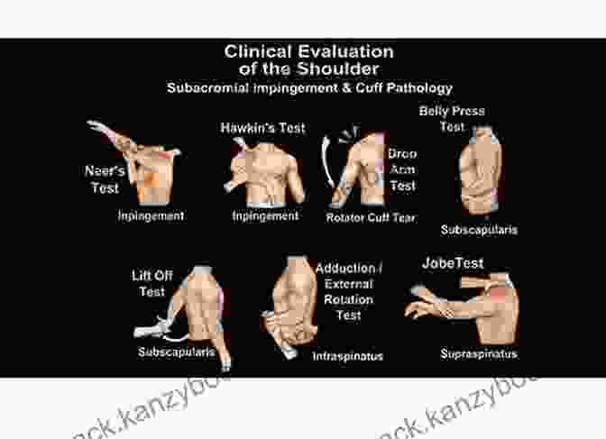 Resisted Range Of Motion Assessment Of Shoulder Scapulothoracic Assessment In Three Simple Steps: Unique Three Dimensional Approach (What S Wrong With My Shoulder? 1)