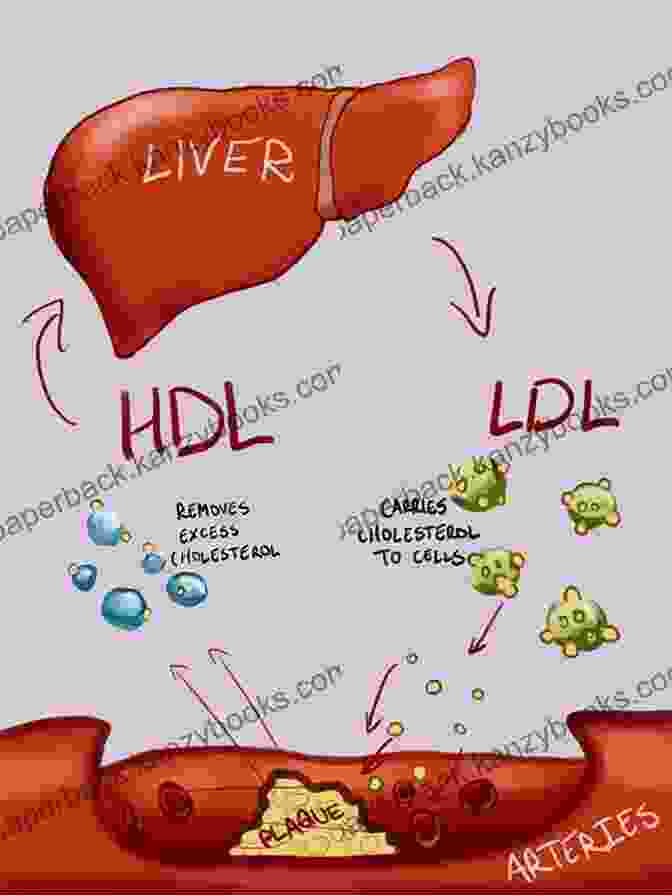 Understanding The Complex Relationship Between Cholesterol And Heart Health The Dark Side Of Statins: Plus: The Wonder Of Cholesterol