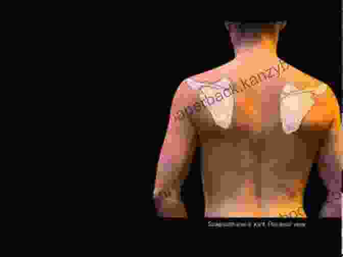 Visual Examination Of Scapulothoracic Region Scapulothoracic Assessment In Three Simple Steps: Unique Three Dimensional Approach (What S Wrong With My Shoulder? 1)