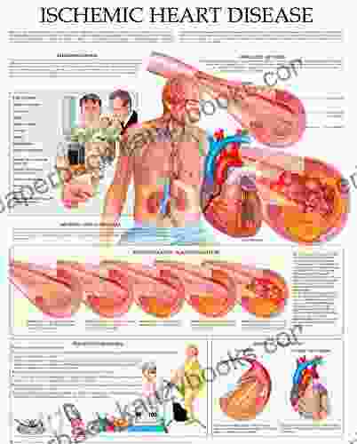 Ischemic Heart Disease E Chart: Quick Reference Guide