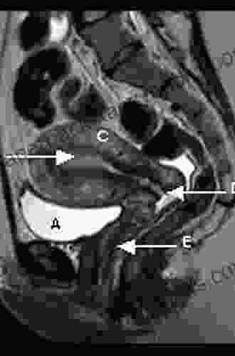 MRI And CT Of The Female Pelvis (Medical Radiology)