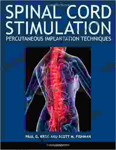 Spinal Cord Stimulation Implantation: Percutaneous Implantation Techniques