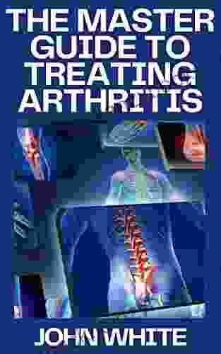 THE MASTER GUIDE TO TREATING ARTHRITIS: The Miracle That Can Halt Reverse And May Even Cure Osteoarthritis