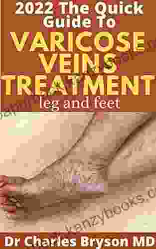 The Quick Guide To Varicose Veins Treatment (legs And Feet): Natural Remedies Supplements And Diet To Improve Varicose Veins Treatment Of Varicose And Telangiectatic Leg Veins (Expert Consult)