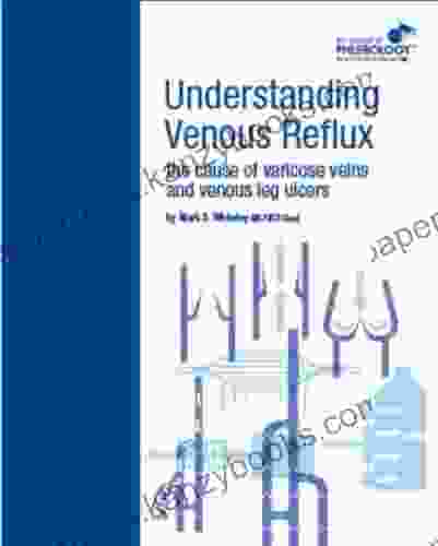 Understanding Venous Reflux The Cause Of Varicose Veins And Venous Leg Ulcers (College Of Phlebology 1)